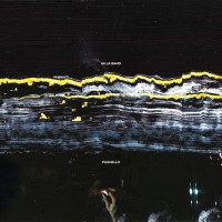 Gilla Band - Pugnello