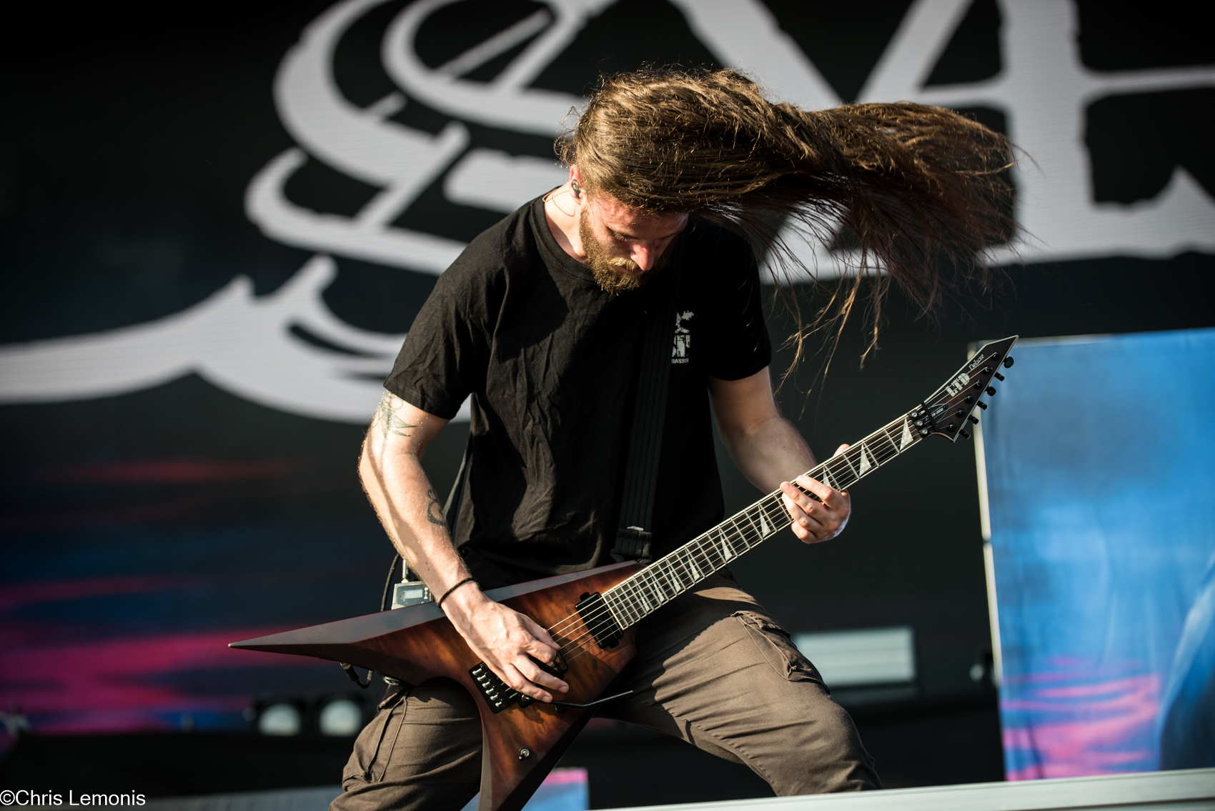 Sylosis