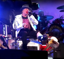 Ο Axl Rose έσπασε το πόδι του! 