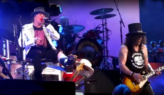 Ο Axl Rose έσπασε το πόδι του!