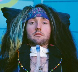 Επιπλοκές παρουσίασε η υγεία του Jason Becker 
