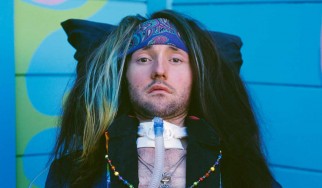 Επιπλοκές παρουσίασε η υγεία του Jason Becker