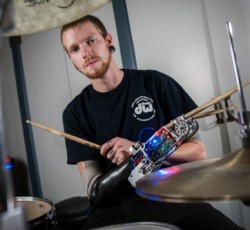 Ρομποτικό μέλος βοηθάει drummer να ξαναπαίξει (video) 