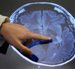 Ακούστε καινούργια μουσική, κάνει καλό στον εγκέφαλο 